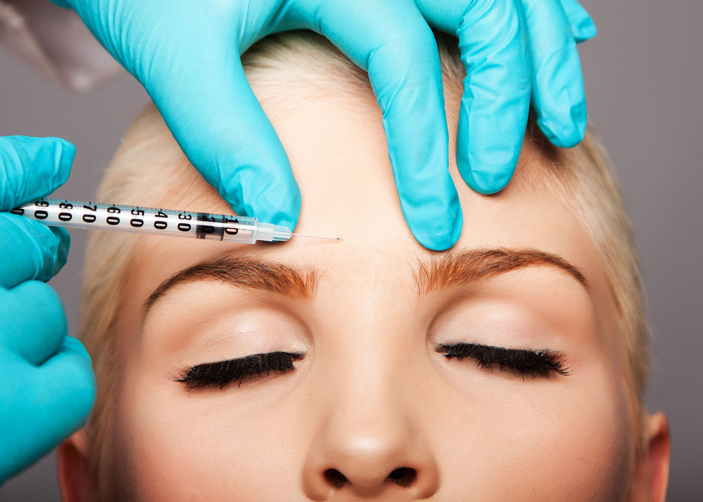 anti wrinkle injections Melbourne